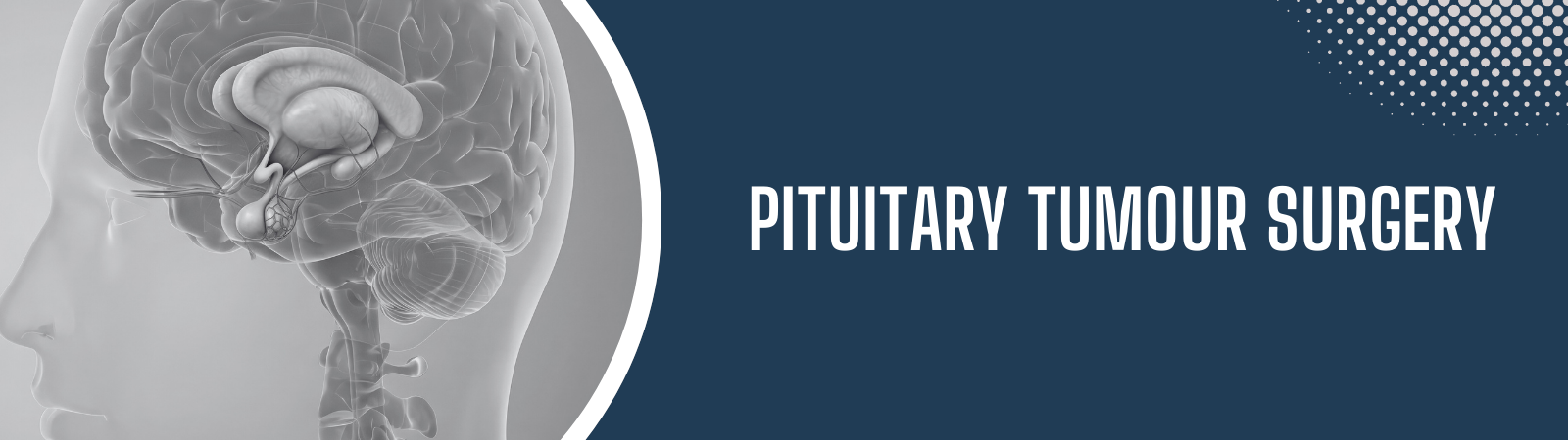Pituitary tumour surgery in Hyderabad by Dr. Sai Shiva Tadakamalla at Gleneagles Aware Hospital