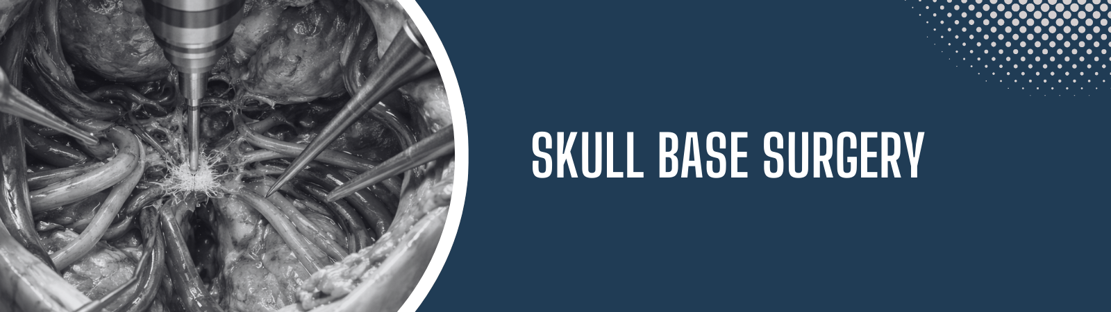 Skull base surgery in Hyderabad by Dr. Sai Shiva Tadakamalla at Gleneagles Aware Hospital LB Nagar