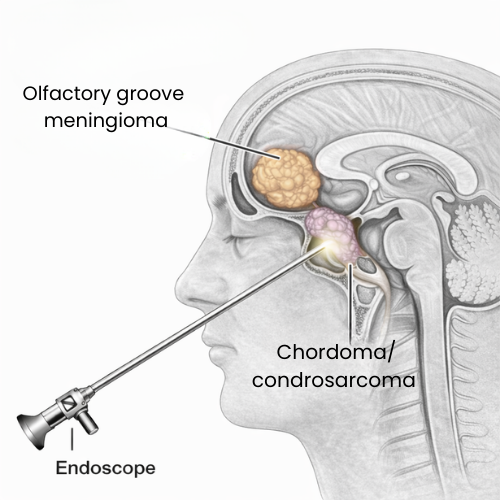 P2 | dr. Sai shiva tadakamalla