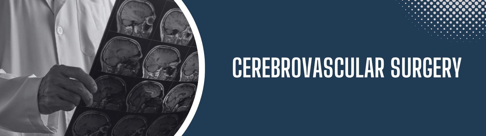 Cerebrovascular surgery in Hyderabad by Dr. Sai Shiva Tadakamalla at Gleneagles Aware Hospital LB Nagar