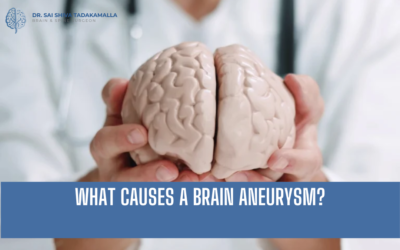 What Causes a Brain Aneurysm?