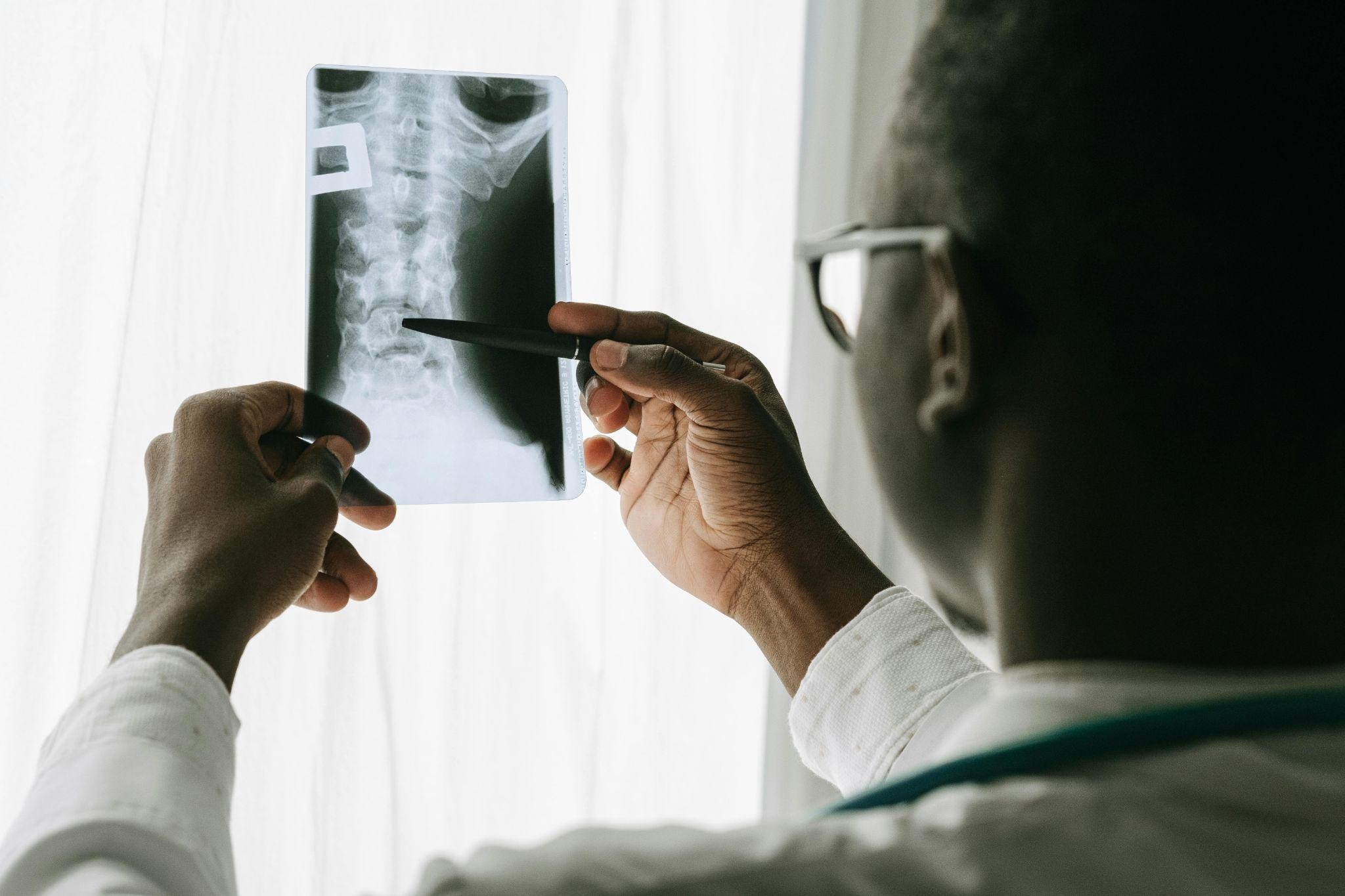 Hormone secreting pituitary tumour treatment in Hyderabad, surgery for acromegaly and Cushing's disease