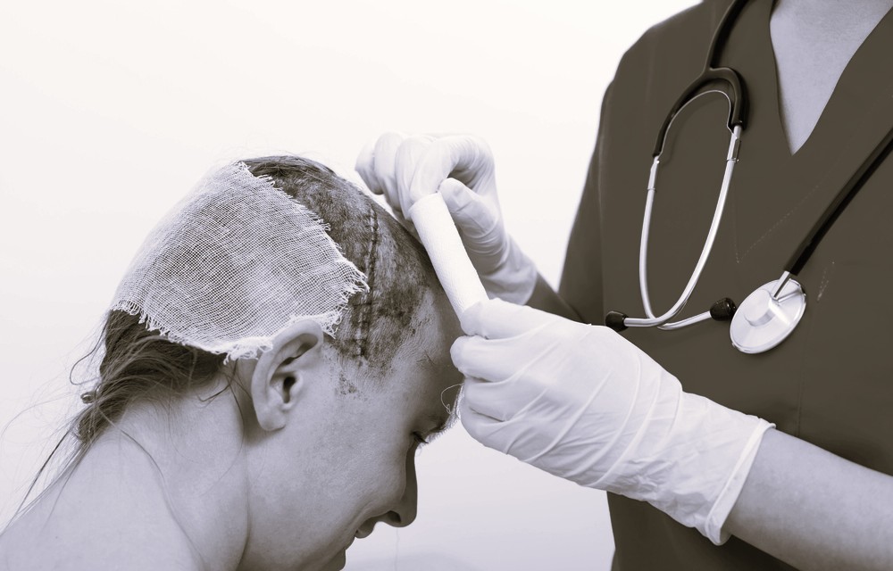 Medical professional in gloves bandaging a patient’s head wound with gauze dressing while kneeling beside them.