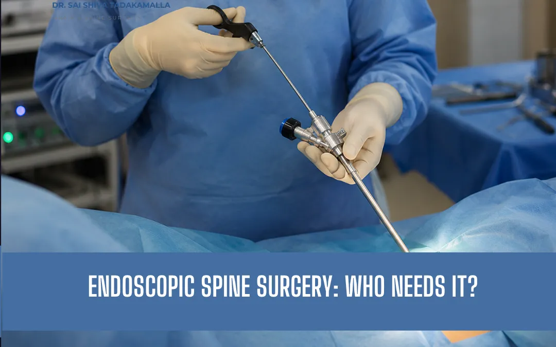 Endoscopic Spine Surgery: Who Needs It?