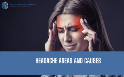 Headache Areas and Their Causes: What the Location of Your Pain Is Trying to Tell You
