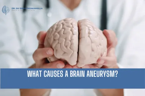 What Causes a Brain Aneurysm?