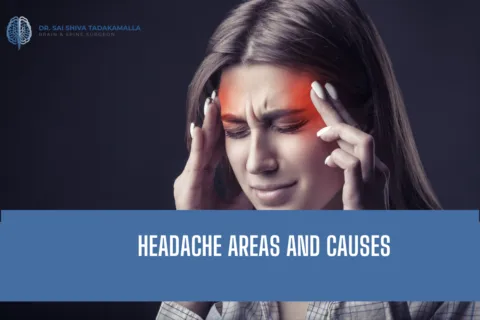 Woman rubbing temples in headache pain, with a blue banner reading 'Headache Areas and Causes' and a medical logo in the top-left corner for Dr. Sai Shiva Tadakamalla.