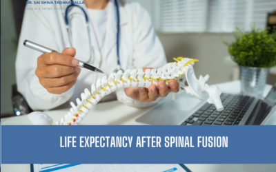 Life Expectancy After Spinal Fusion: What the Surgery Really Changes