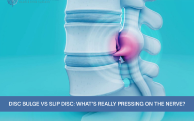 Disc Bulge vs Slip Disc: What’s Really Pressing on the Nerve?