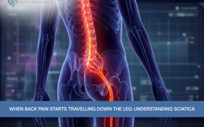 When Back Pain Starts Travelling Down the Leg: Understanding Sciatica