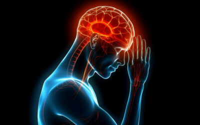 A Brain Aneurysm Can Stay Silent Until It Ruptures